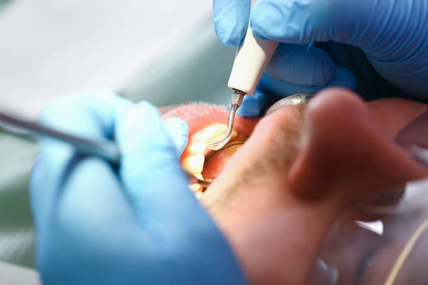 Best Emergency Treatment for Toothache in The Dalles, OR
