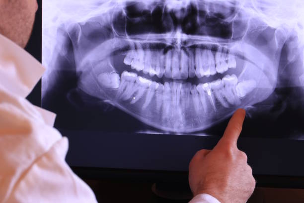 Best Walk-In Emergency Dentist in The Dalles, OR